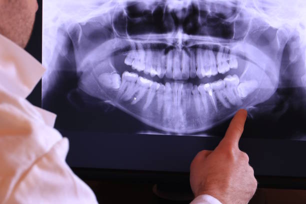 Best Emergency Treatment for Dental Infections or Abscesses in Apple Valley, OH