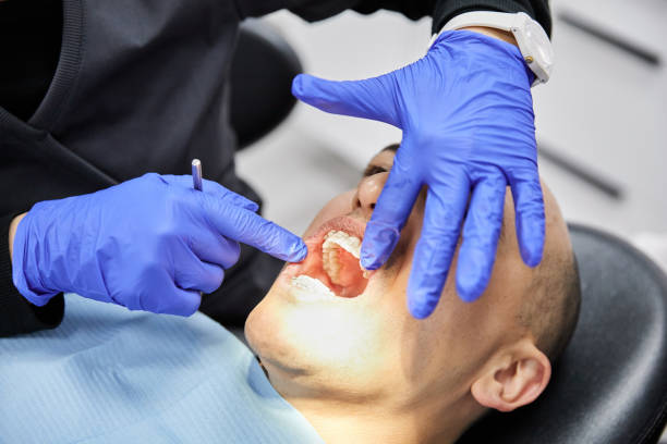 Best Emergency Treatment for Dental Infections or Abscesses in Apple Valley, OH